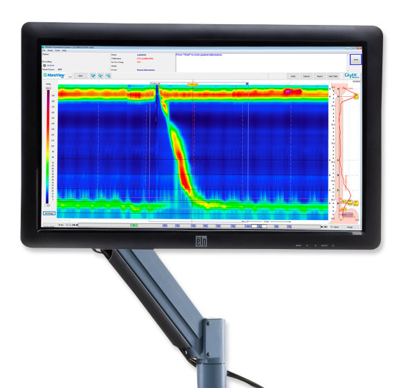 MANOSCAN ESO Z CATH X1
