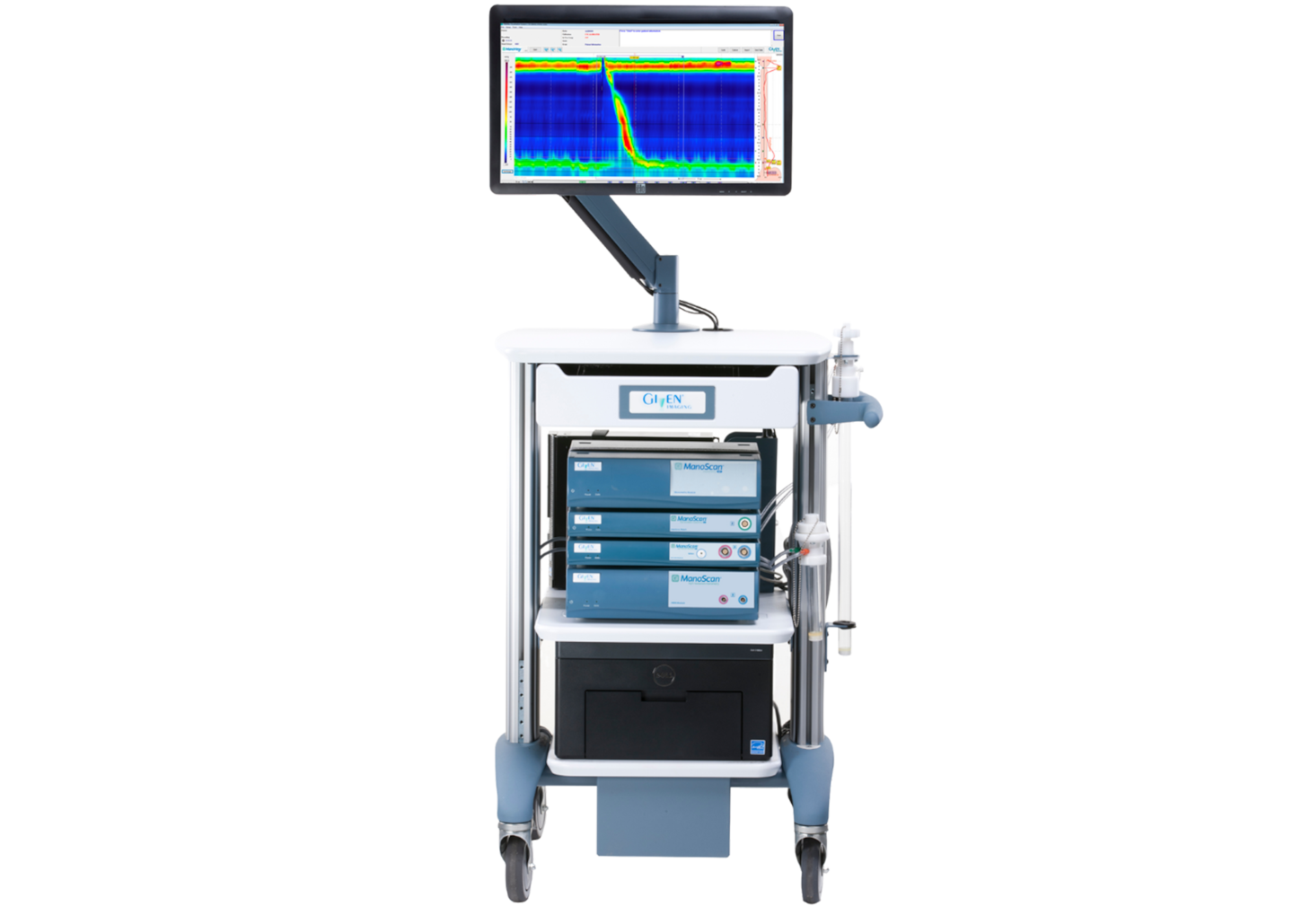 MANOSCAN ESO Z CATH X1