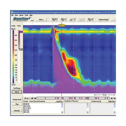 ManoScan™ Acquisition Software