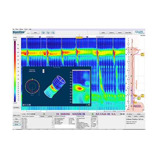 ManoView™ ESO Analysis Software