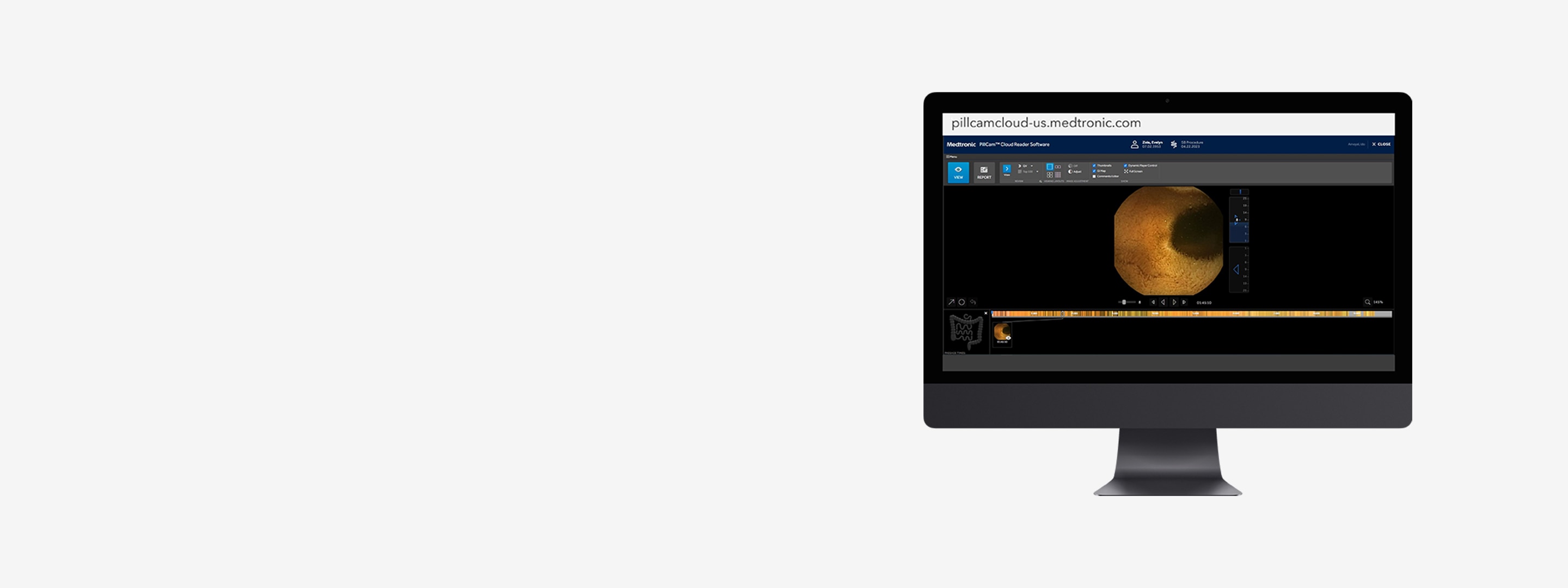 RAPID reader for PillCam software reviewing a capsule endoscopy study