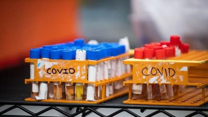 COVID-19- Credit to Canadian Press By Canadian Press
Pfizer COVID-19 vaccine candidate one step closer to approval