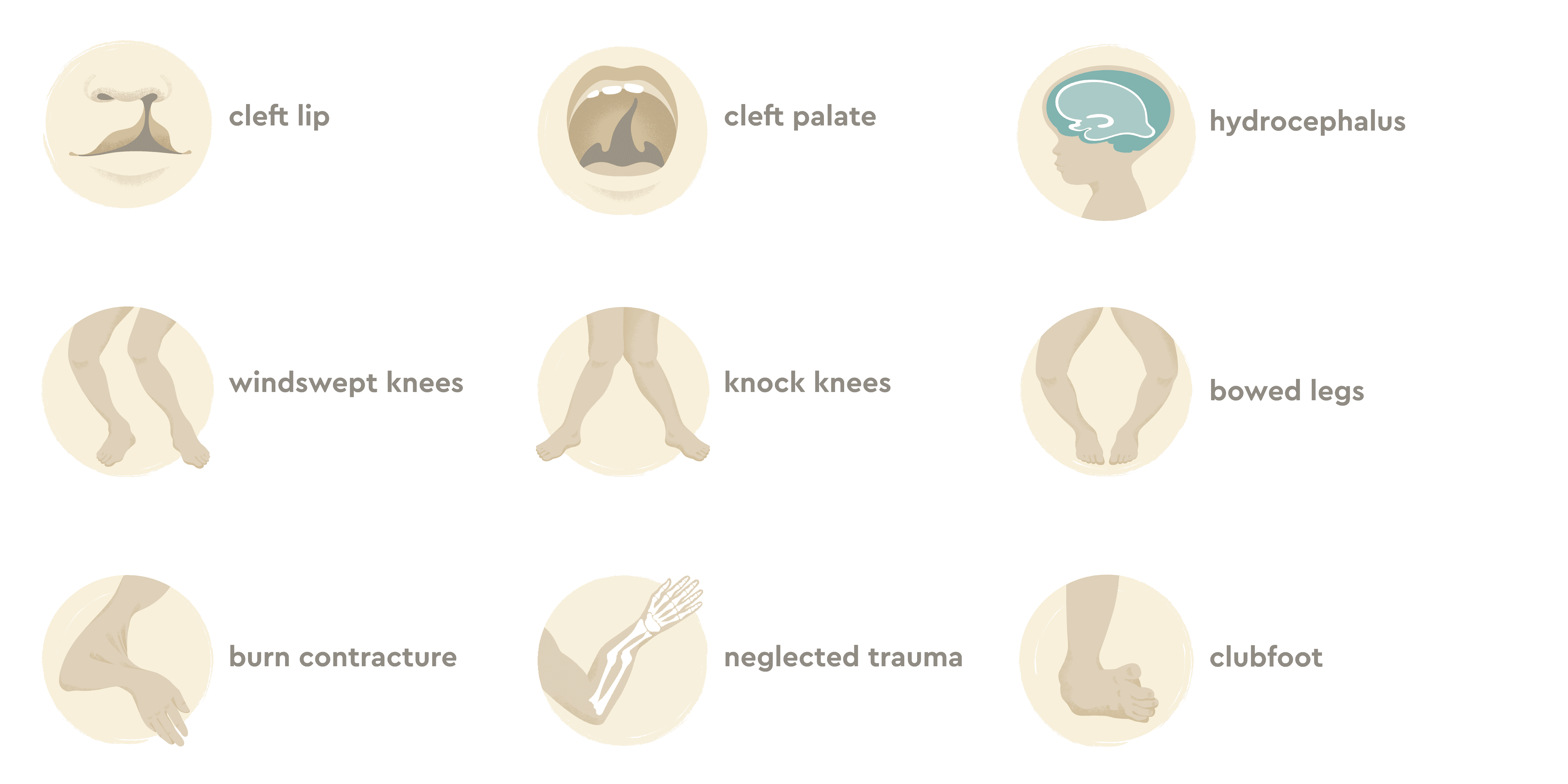 Conditions treated by CURE Organization