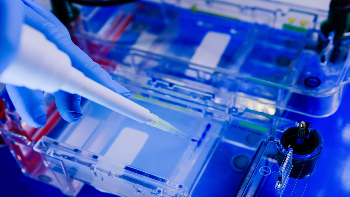 Protein Electrophoresis