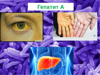 Дизентерия Зонне и гепатит А.  Лучшая профилактика – вакцинация