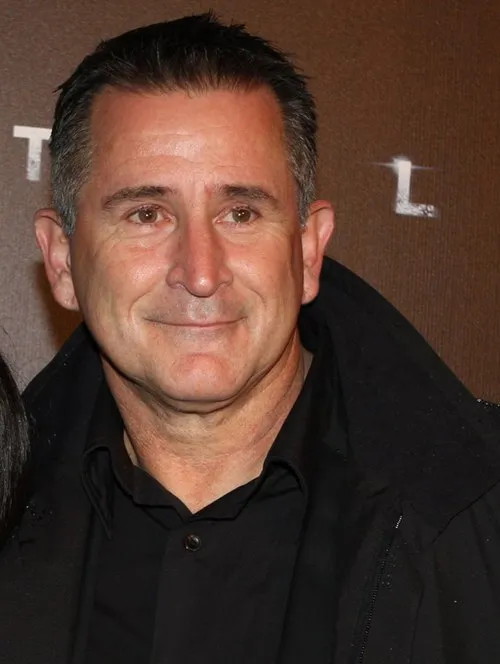 Anthony LaPaglia