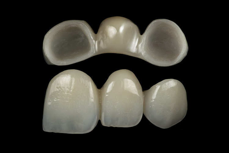 Zirkonia bro, multilayer