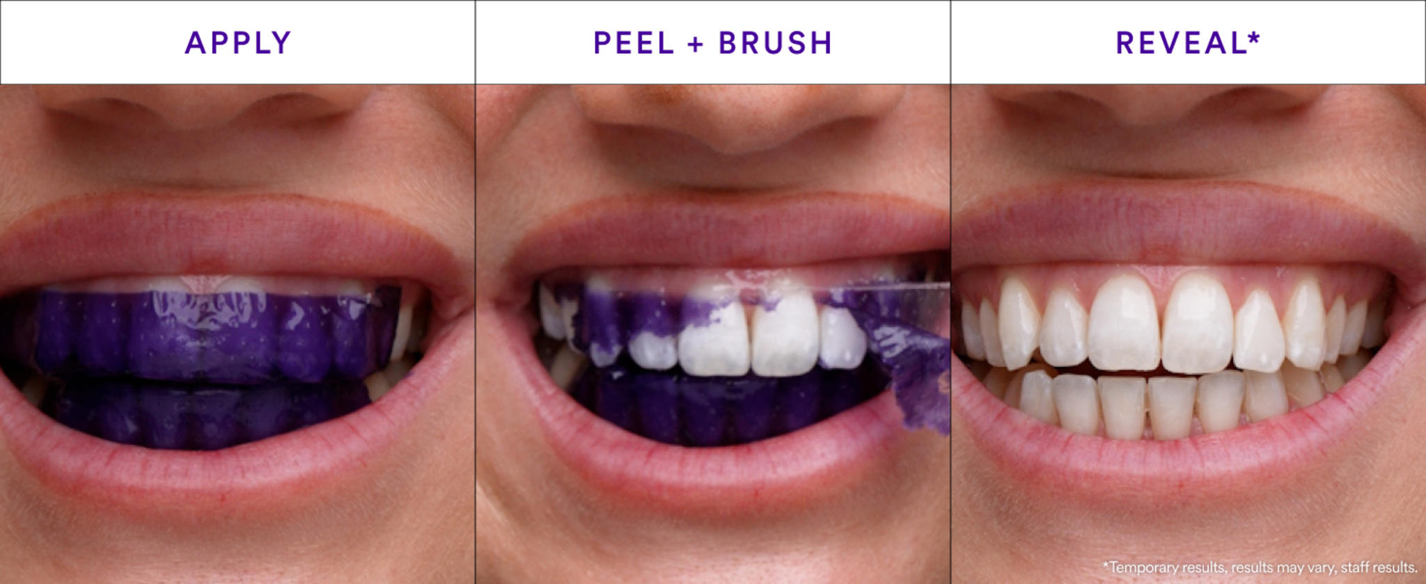 V34 Purple Teeth Whitening Strips - 30-Minute Whitening Treatment image 3