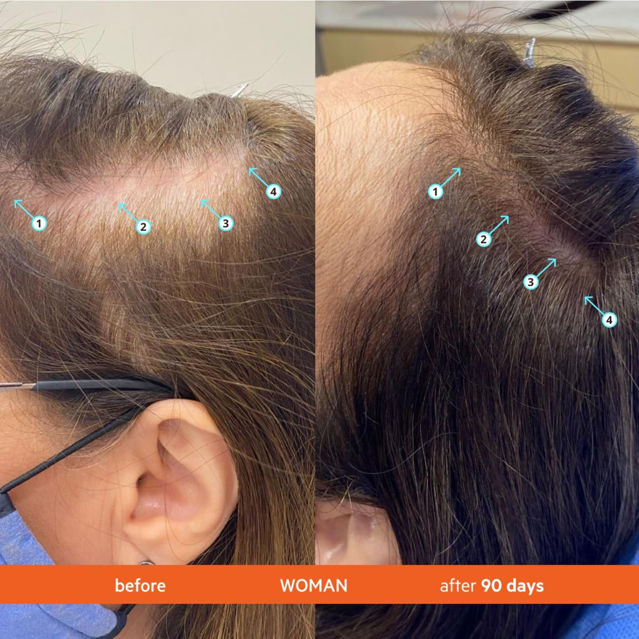 Volumizing Shampoo for Fuller Looking Hair, Scalp Refreshing Cleanse & Lightweight Hydration, 205 mL