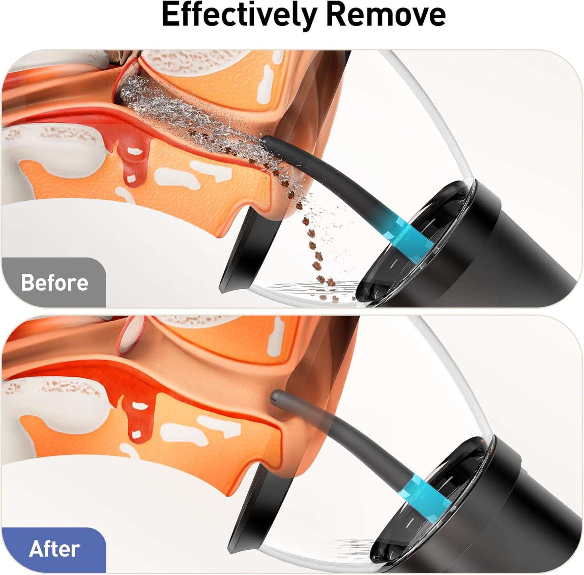 Electric Ear Wax Removal Kit with Camera, 4 Pressure Modes, IPX6 Waterproof Rechargeable Ear Cleaner