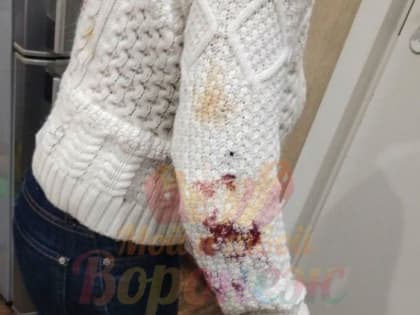 Бездомные собаки напали на женщину в Ленинском районе Воронежа