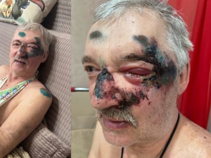 В Воронеже на зебре сбили врача с супругой