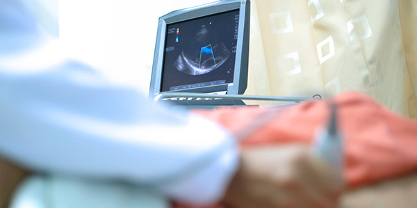 Pemeriksaan EKG