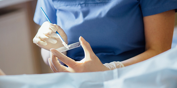 Tes Pap Smear