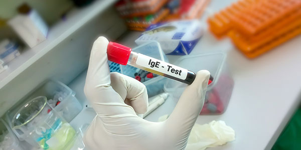 Test Alergi IgE Atopy