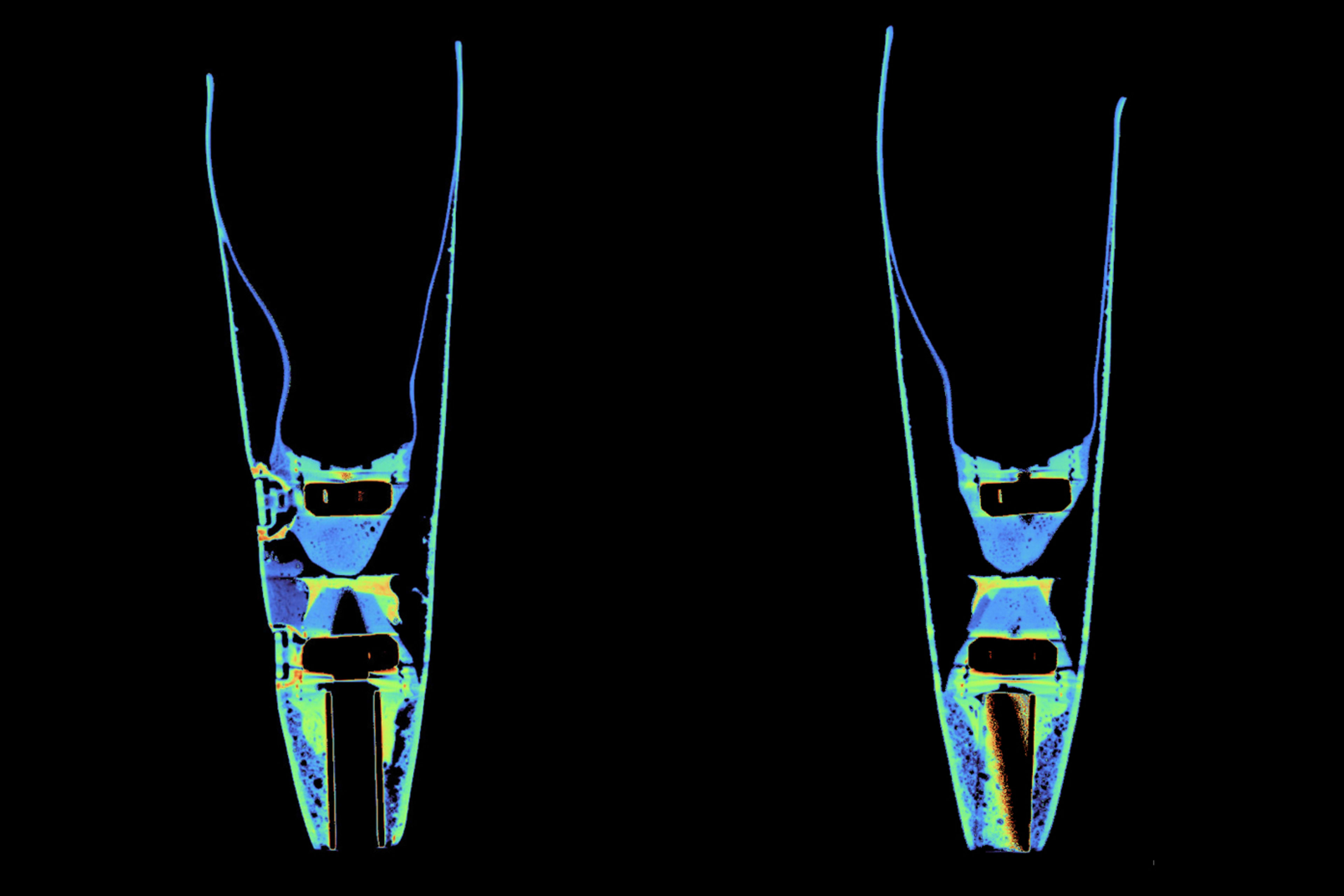 Front and back cross-sectional CT scans of Bebe Vio's prosthetic sit on a black background. The multi-colored scan provides the detailed shape of all internal components.