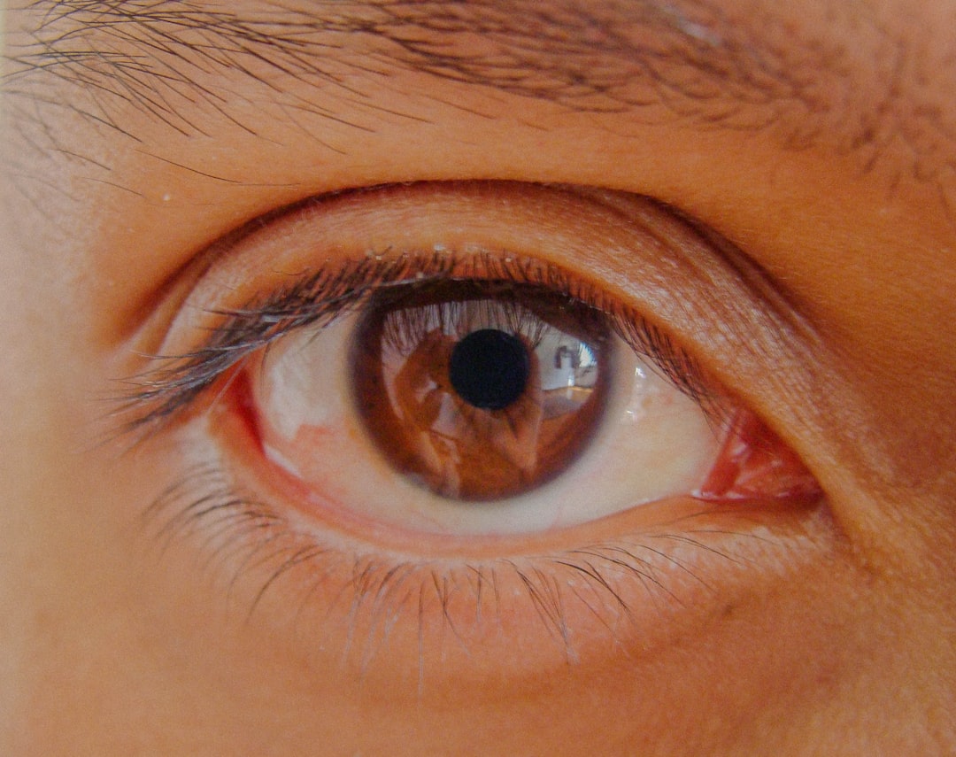 Limit Screen Time Reduce Eye Strain