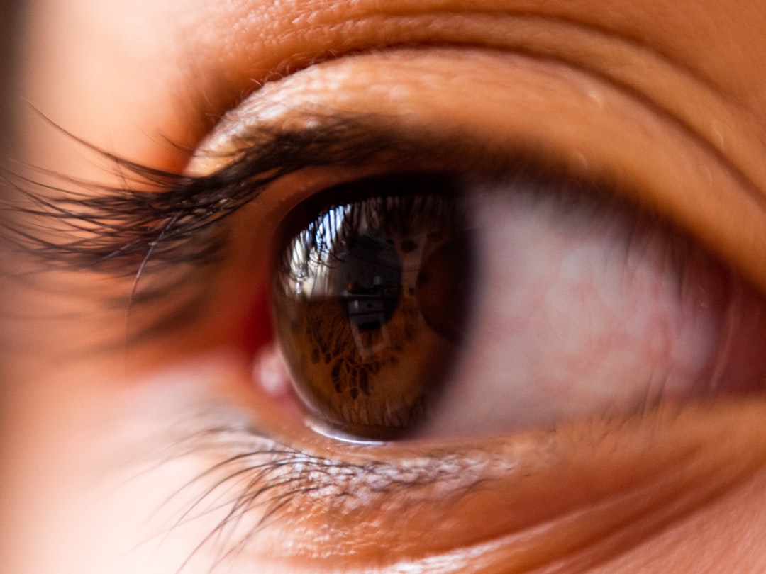 Understand The Symptoms Of Glaucoma