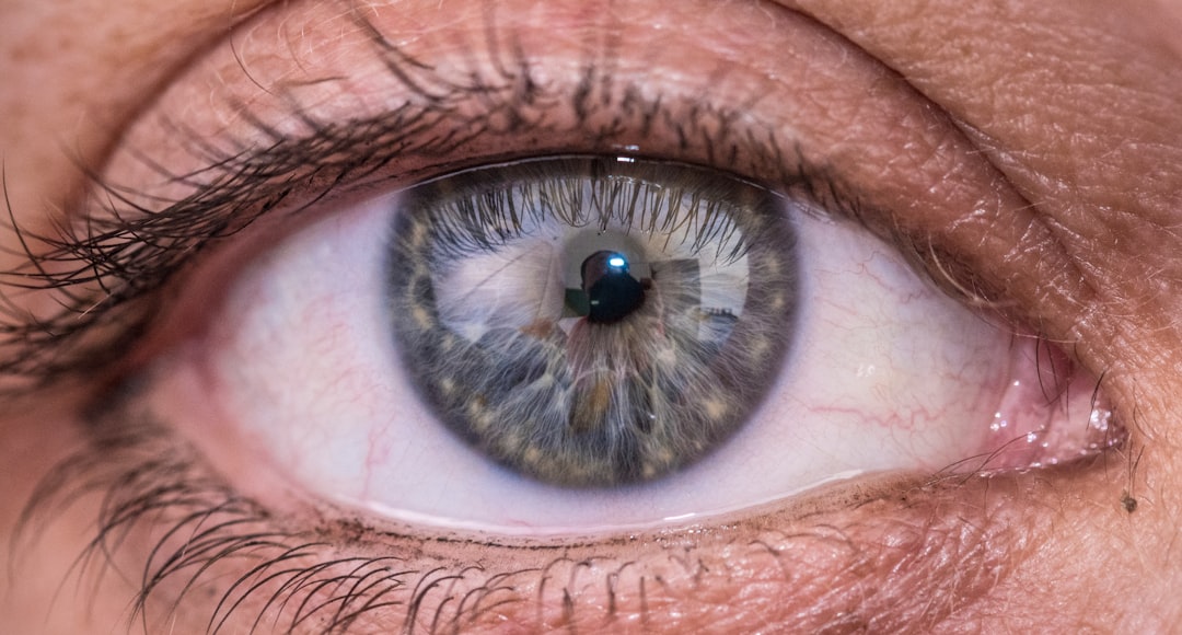 macular degeneration