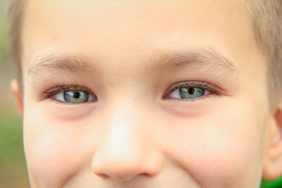 Why Do Eyes Misalign? Understanding Strabismus