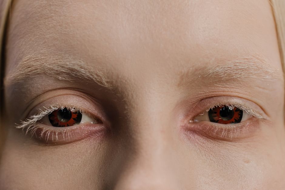 The Real Cost of Sleeping in Your Contact Lenses