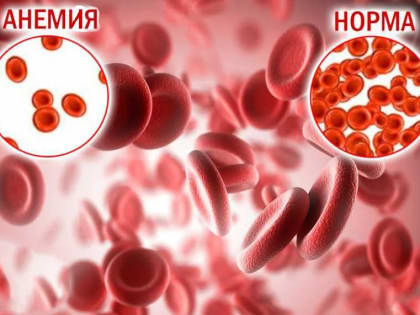 От анемии: какие продукты нужно есть, чтобы повысить уровень гемоглобина