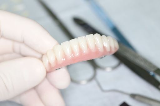 Quais Os Tipos De Prótese Dentária E Para Que Servem Referência Em 5931