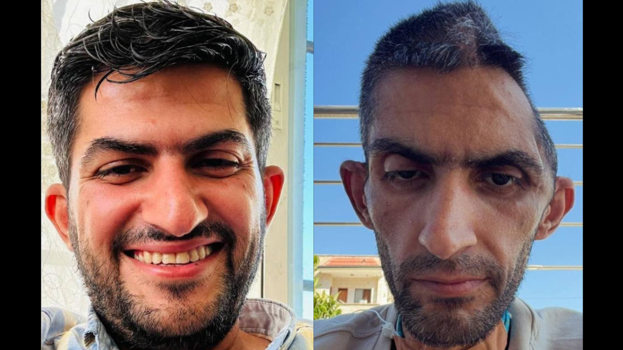 Denuncian el estado de un periodista palestino tras su liberación de una prisión israelí y reavivan críticas al sistema de detención