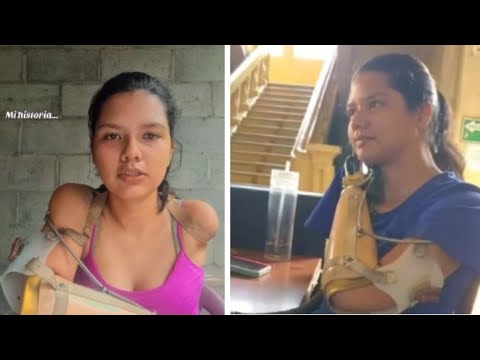 Joven relata en redes cómo perdió a su madre y sus manos tras ataque de pandilleros