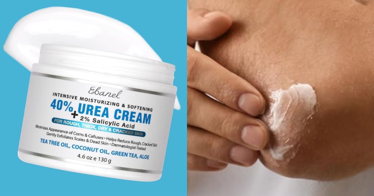 Ebanel Urea Cream: A High-Concentration Solution for Treating Rough and Cracked Skin