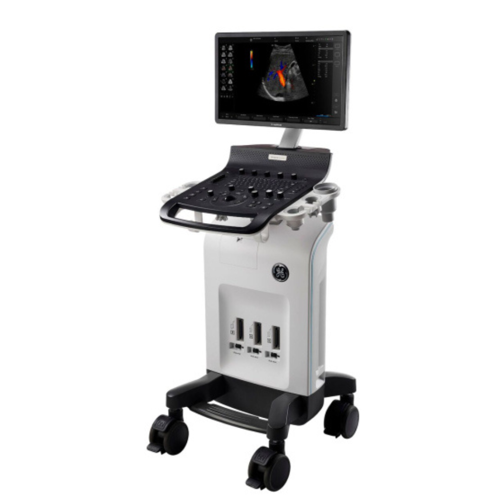 GE Versana Essential Ultrasound System