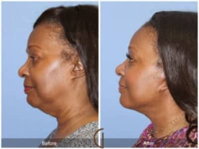Real women reveal INCREDIBLE results