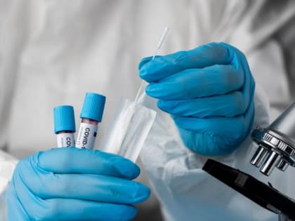 Заболеваемость коронавирусом на Ставрополье достигла исторического минимума