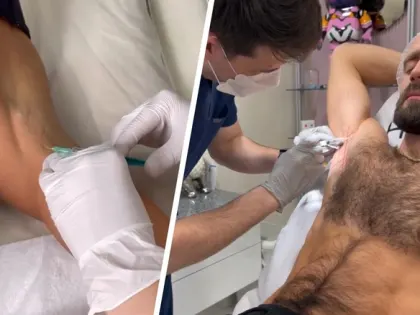 А руки не парализует? Блогеры начали колоть ботокс в подмышки, чтобы не потеть. Узнали у косметолога, безопасно ли это