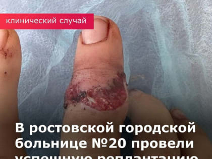 В РОСТОВСКОЙ ОБЛАСТИ ВРАЧИ ВОССТАНОВИЛИ ШКОЛЬНИЦЕ ПАЛЕЦ ПОСЛЕ ПОЛНОГО ОТРЫВА В РАЙОНЕ СРЕДНЕЙ ФАЛАНГИ