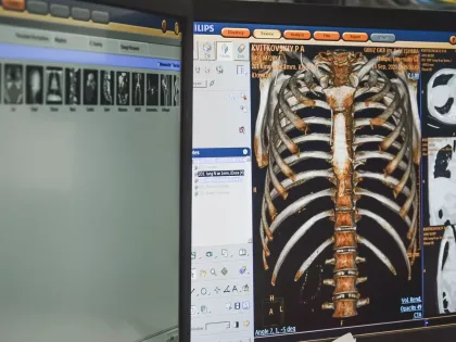 Программиста из Ростова-на-Дону нашли на улице в Таиланде с пробитым легким