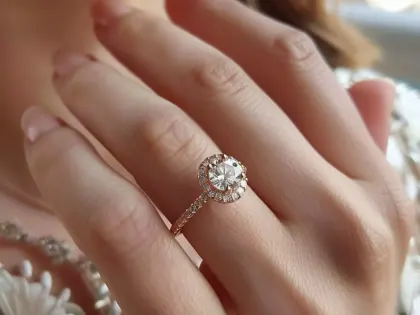 Нестерпимые боли испытывала ростовчанка из-за обручального кольца