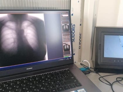 Передвижной флюорографический комплекс начнет работать в Морозовском районе