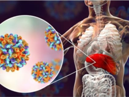 Какой гепатит самый опасный?