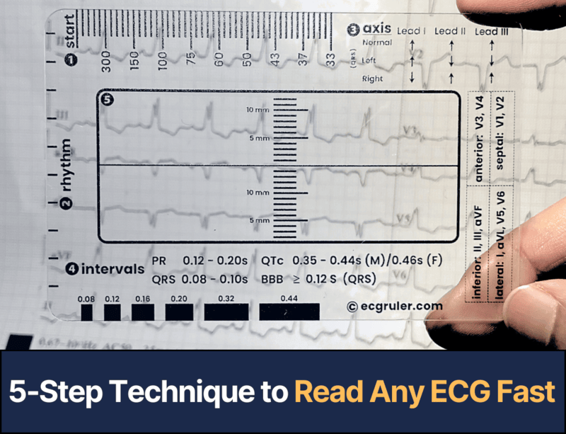 ECG Ruler