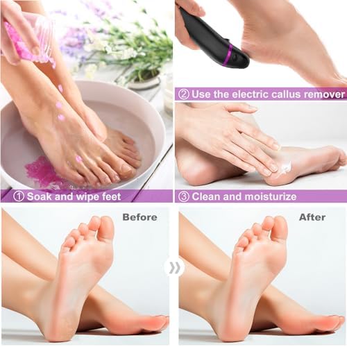 Vue 5 de Rapeuse Pieds Electrique En