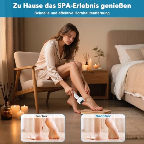 Vue 2 de Mycarbon Rapeuse Pieds Electrique