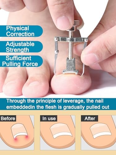 Vue 3 de Ongle Incarne Kit Pedicure