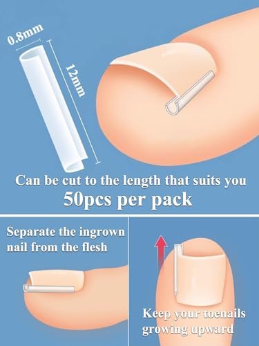 Vue 5 de Ongle Incarne Kit Pedicure