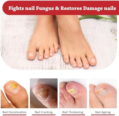 Vue 4 de Traitement Mycose Ongles Des