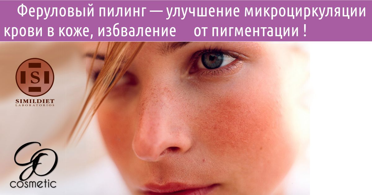 Феруловый пилинг