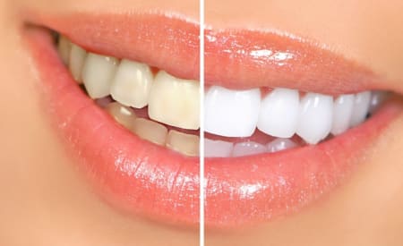 Dental SPA Fleming