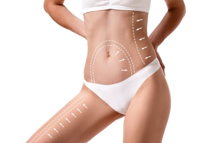 Liposuzione Laser Torino EsteticAmica -53%