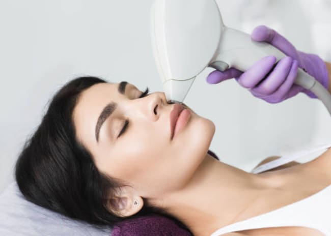 3 o 5 sedute di epilazione laser su zone piccole, medie o combinate Beauty Advance Elite -90%