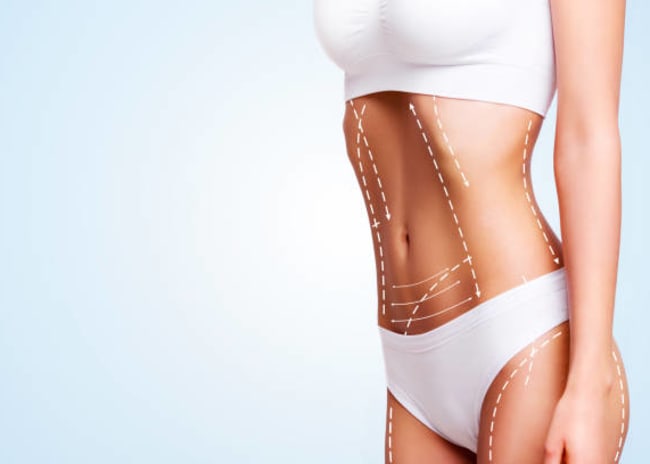 1 o 2 sedute di rimodellamento con Liposcultura -84%